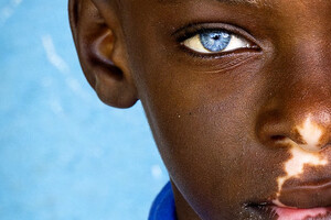 Winnaars van de IAPB World Sight Day Fotowedstrijd bekendgemaakt