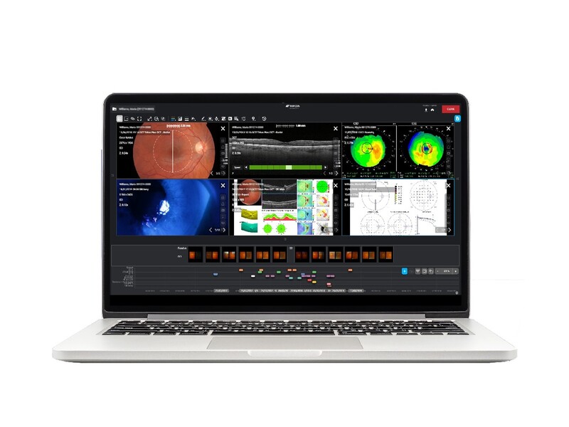 O’Max Instruments introduceert Topcon Harmony