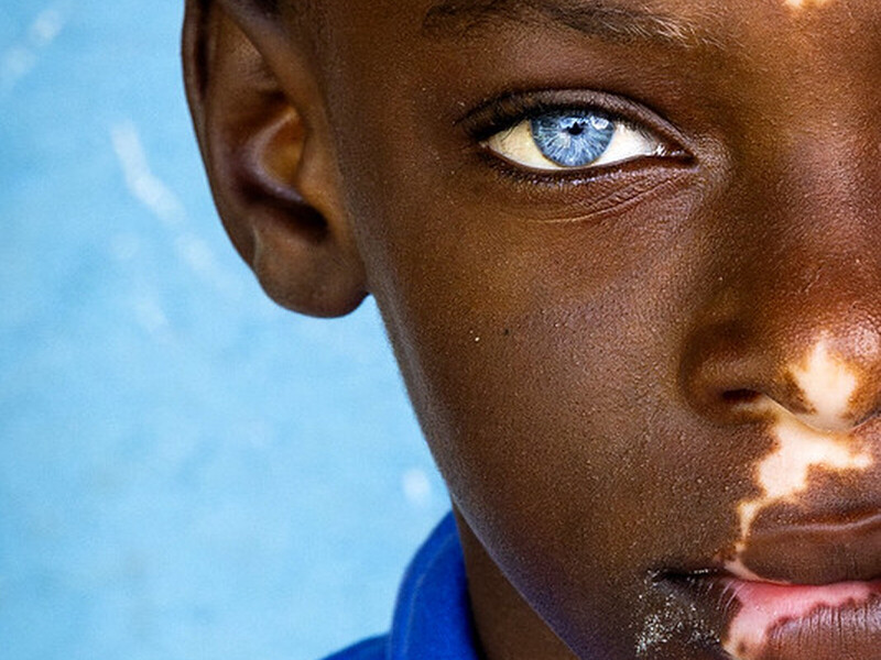 Winnaars van de IAPB World Sight Day Fotowedstrijd bekendgemaakt